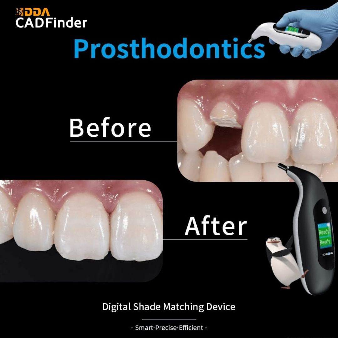 CAD Finder Digital Shade Matching Device